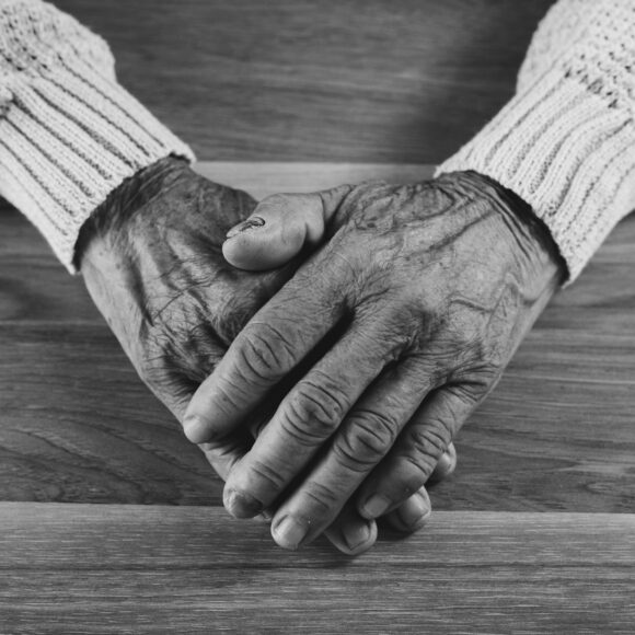 ageing women hands